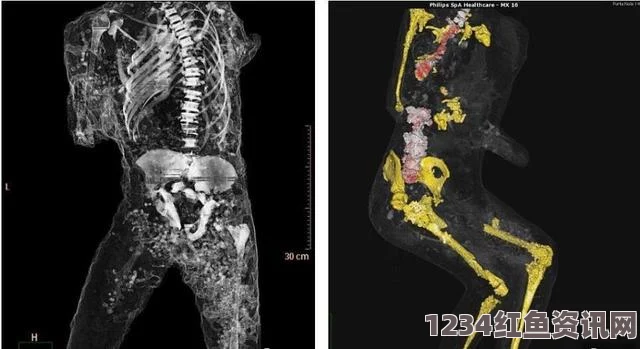 庞贝古城木乃伊的CT扫描揭秘，死前的惊恐表情与千年历史的见证