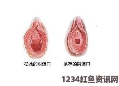 探讨女性身体健康：一动下身就有水样分泌物的原因及对策