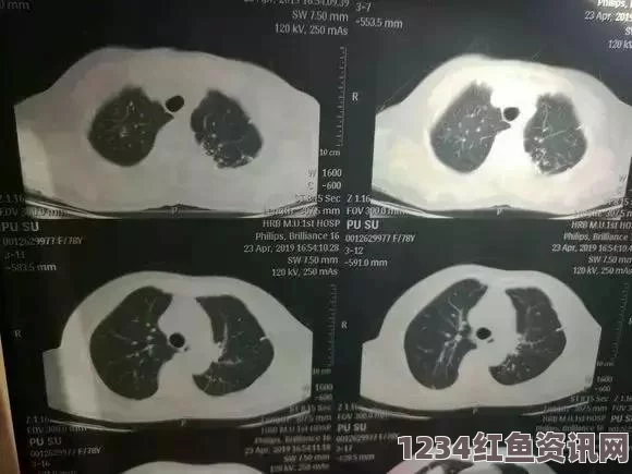 让大爷再帮你排排毒，重拾健康生活新方式