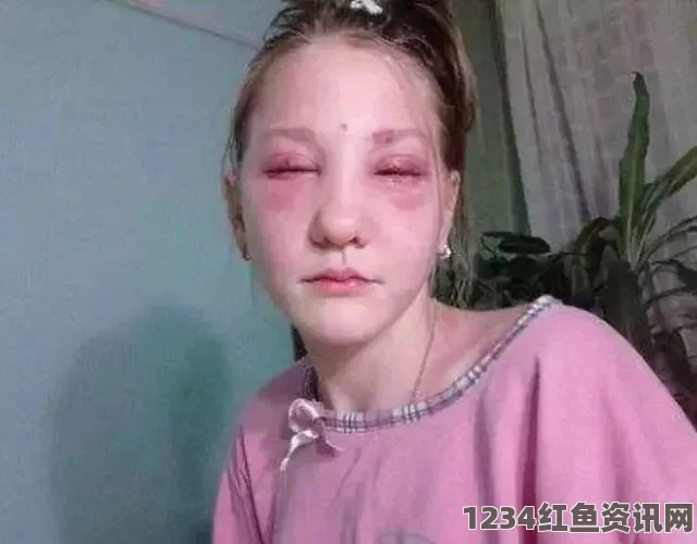 阿根廷15岁少女因绝美面容惨遭毁容，悲剧背后的警示与反思