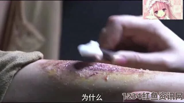 男子腹部惊现神秘红色痕迹，医生检查竟发现蜘蛛钻进皮肤深处（图文详解）