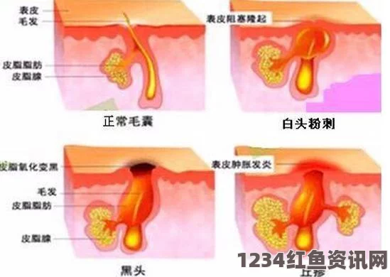 草莓香蕉榴莲丝瓜18岁是否可以吃？适宜食用的注意事项揭秘